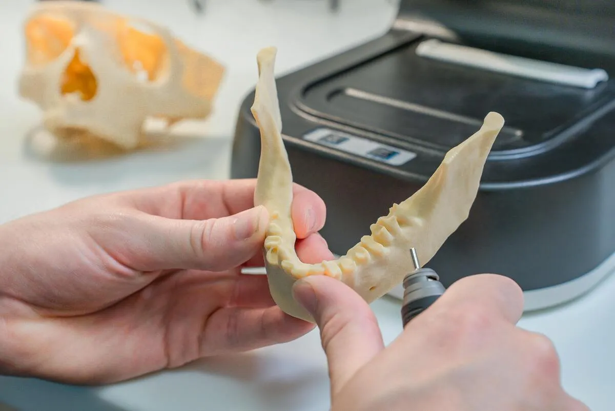 Does Illinois Medicaid Cover Dental Implants? What Adults Need to Know