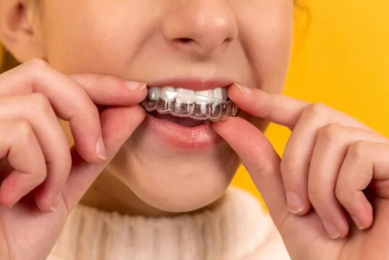 does-medicaid-cover-braces-in-indiana