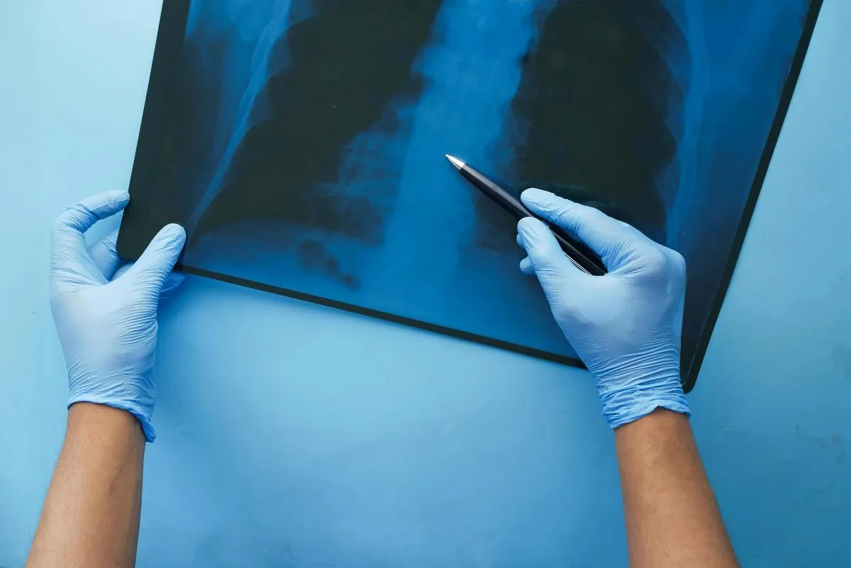 Does Medicaid Cover Breast Reduction? Eligibility and Medical Necessity