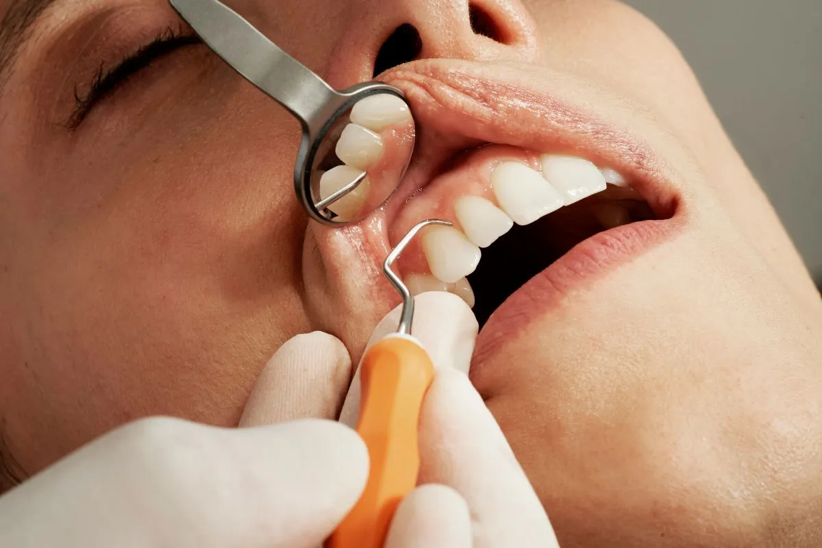 Does Medicaid Cover Dental Implants? The Truth About Dental Coverage
