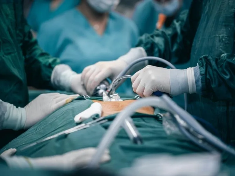 does medicaid cover gastric bypass