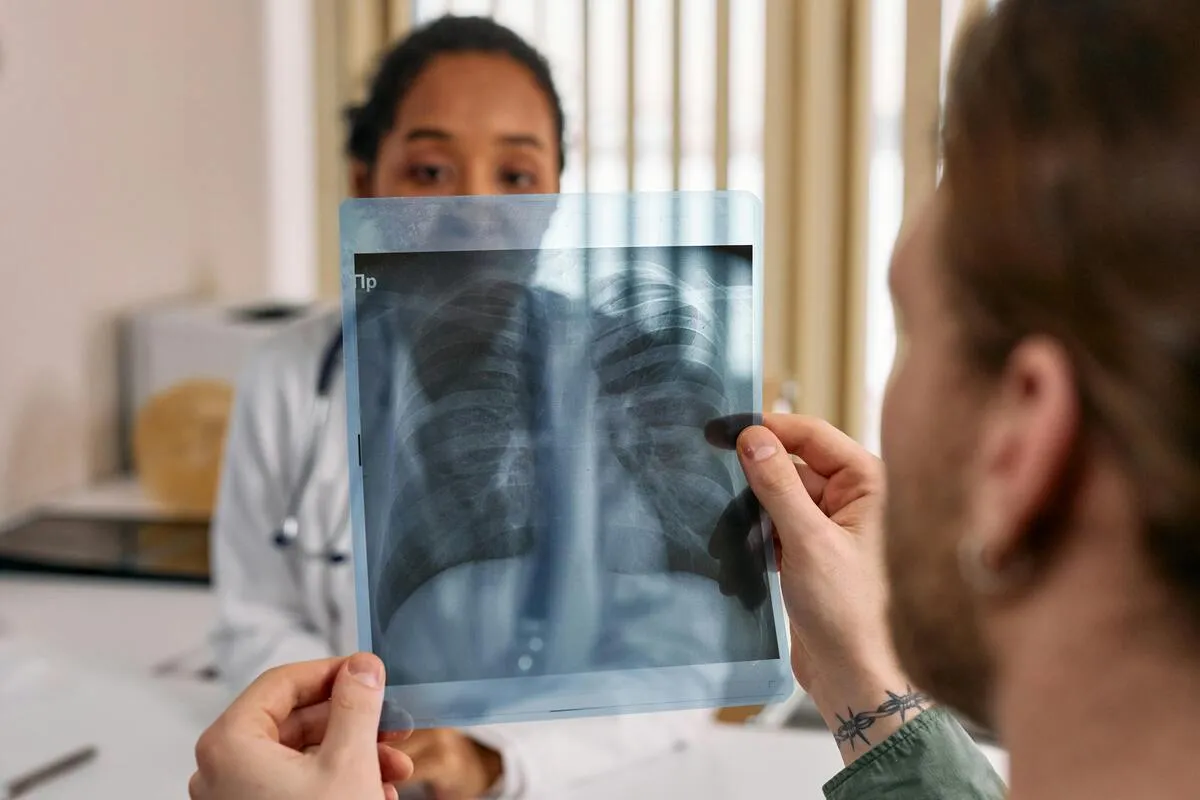 Does Medicaid Cover TB Test Costs? Coverage Rules, Exceptions, and Pricing Explained