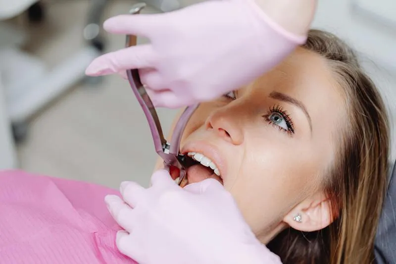 Is-wisdom-teeth-removal-covered-by-insurance