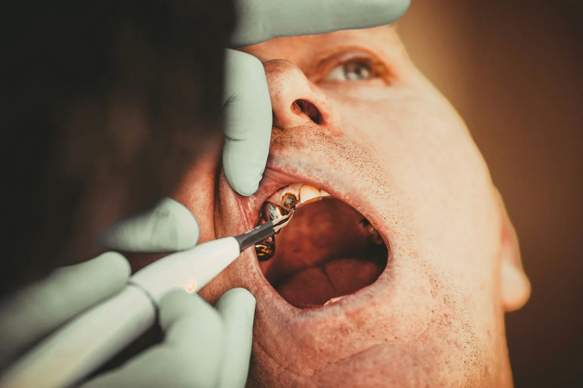 Does Medicaid Cover Wisdom Teeth Removal? Emergency Guide 2026