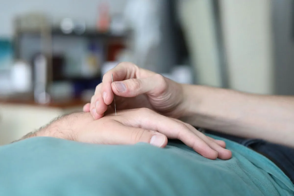 Does Medicare Cover Acupuncture? Expert Advice 2026