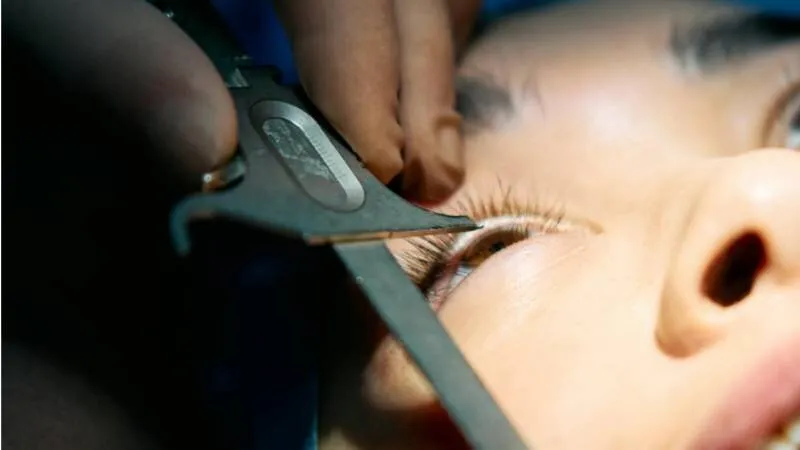 does-medicare-cover-cataract-surgery-1