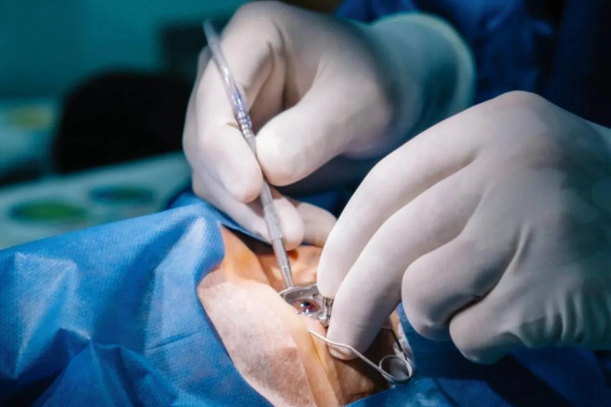 Does Medicare Cover Cataract Surgery? Important Costs Seniors Should Know