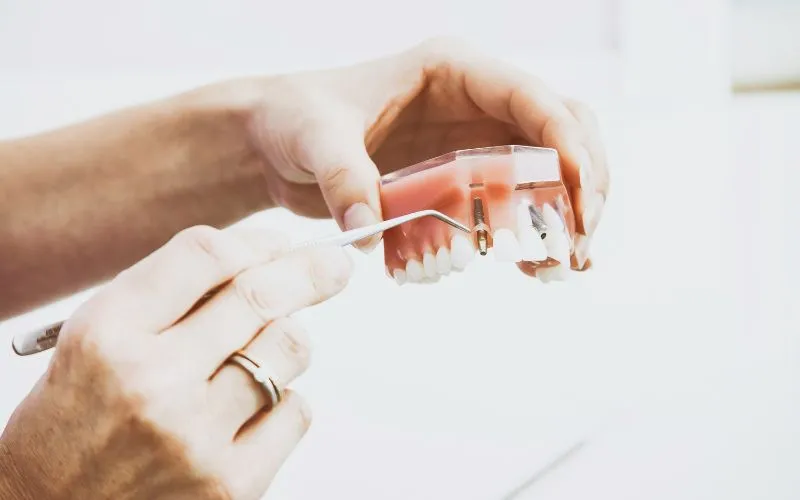 does-medicare-cover-dental-implants-dental-services