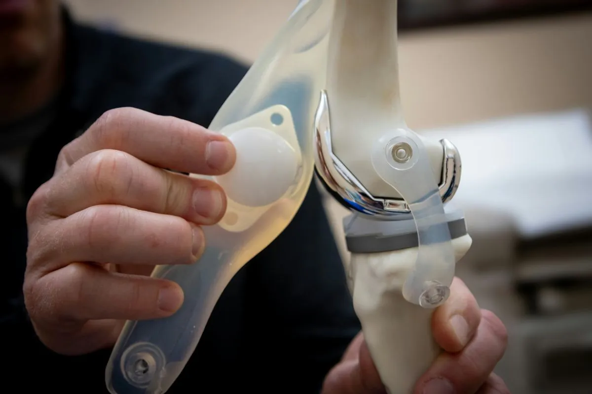 Does Medicare Cover Knee Replacement in 2026? Costs, Coverage & Limits Explained