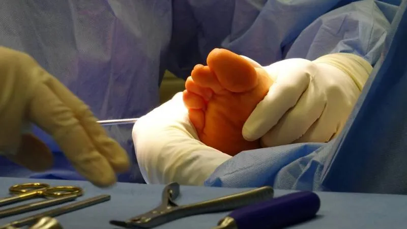does-medicare-cover-podiatry-1