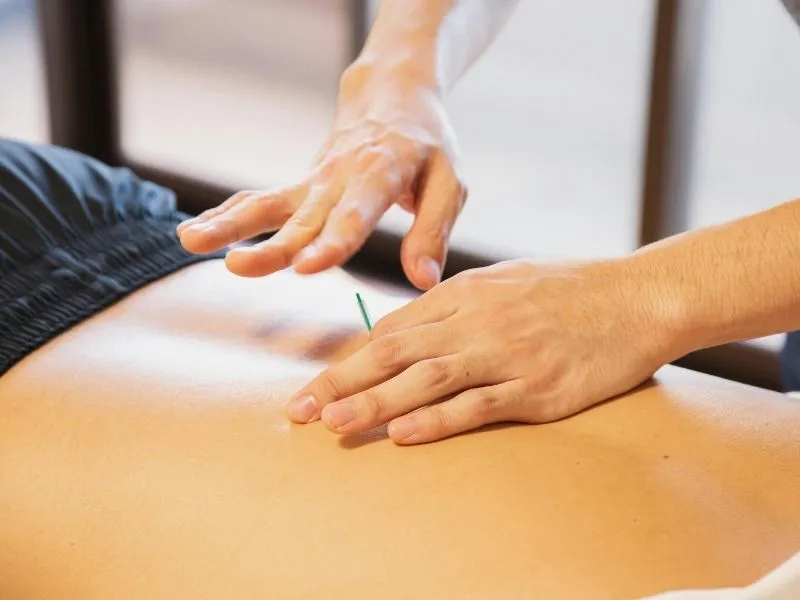 does medicare pay for acupuncture