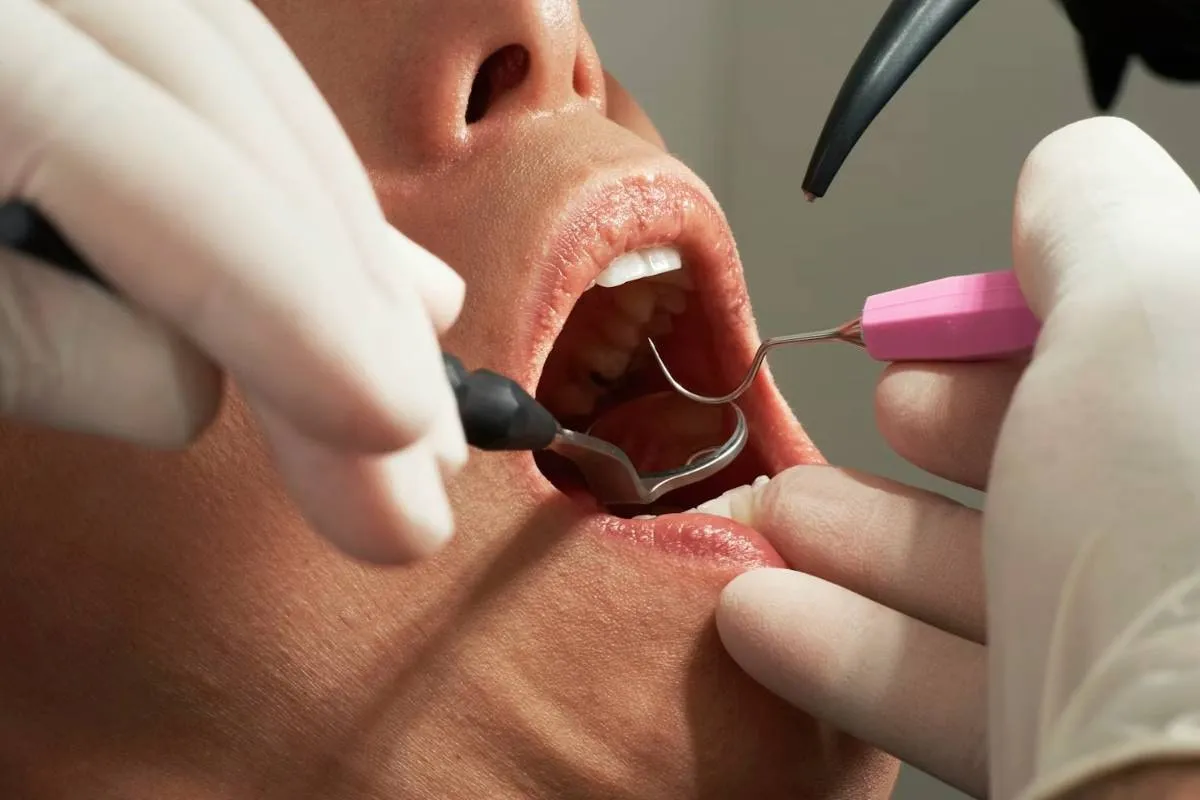 Free Dentures for Low-Income Adults: Programs That Help and How to Qualify