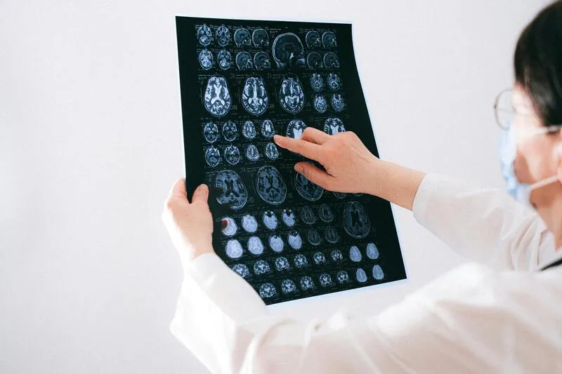 how-much-is-a-disability-check-for-epilepsy