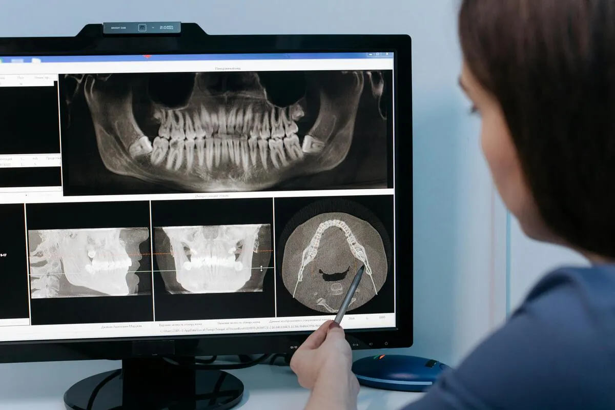 How to Find Orthodontist That Accept Medicaid & Get Benefits You May Haven’t Known