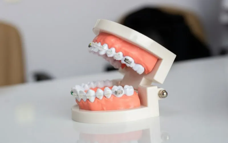 orthodontist-that-accept-medicaid-how-to-verify