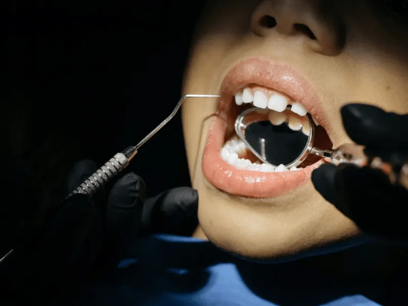 Who-qualifies-for-free-braces